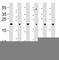 Dihydrofolate Reductase antibody, F52556-0.4ML, NSJ Bioreagents, Immunohistochemistry paraffin image 