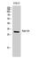 RAB6A, Member RAS Oncogene Family antibody, A02911, Boster Biological Technology, Western Blot image 