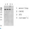 Eukaryotic Translation Elongation Factor 2 antibody, LS-C813402, Lifespan Biosciences, Western Blot image 