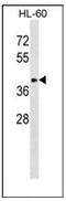 ST8 Alpha-N-Acetyl-Neuraminide Alpha-2,8-Sialyltransferase 6 antibody, AP54061PU-N, Origene, Western Blot image 