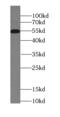 Roundabout homolog 3 antibody, FNab07374, FineTest, Western Blot image 