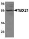 T-box transcription factor TBX21 antibody, TA326655, Origene, Western Blot image 