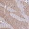 Myosin regulatory light chain 2A, cardiac muscle isoform antibody, NBP1-85541, Novus Biologicals, Immunohistochemistry frozen image 