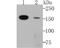 SWI/SNF Related, Matrix Associated, Actin Dependent Regulator Of Chromatin Subfamily C Member 1 antibody, NBP2-75666, Novus Biologicals, Western Blot image 