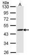 Fumarylacetoacetate Hydrolase antibody, NBP1-33662, Novus Biologicals, Western Blot image 