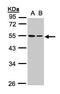 Tubulin beta-1 chain antibody, TA307997, Origene, Western Blot image 