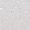 Homeobox A11 antibody, PA5-57341, Invitrogen Antibodies, Immunohistochemistry frozen image 