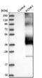 Potassium Two Pore Domain Channel Subfamily K Member 1 antibody, HPA016049, Atlas Antibodies, Western Blot image 