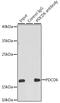 Programmed Cell Death 6 antibody, GTX33394, GeneTex, Immunoprecipitation image 