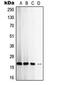 TIMP Metallopeptidase Inhibitor 2 antibody, LS-C352955, Lifespan Biosciences, Western Blot image 