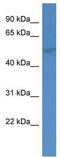 Glucocorticoid Modulatory Element Binding Protein 1 antibody, TA334739, Origene, Western Blot image 