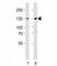 GLI Family Zinc Finger 2 antibody, F52545-0.4ML, NSJ Bioreagents, Western Blot image 