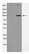 EPH Receptor A2 antibody, TA347931, Origene, Western Blot image 