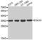 Egl-9 Family Hypoxia Inducible Factor 3 antibody, MBS127059, MyBioSource, Western Blot image 