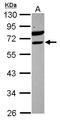 ETS Variant 6 antibody, LS-C155241, Lifespan Biosciences, Western Blot image 