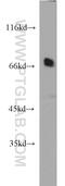 Sorting Nexin 18 antibody, 21946-1-AP, Proteintech Group, Western Blot image 