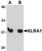 T-cell surface glycoprotein YE1/48 antibody, NBP1-77343, Novus Biologicals, Western Blot image 