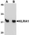 Ly-49a antibody, NBP1-77343, Novus Biologicals, Western Blot image 