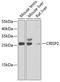 Cysteine Rich Secretory Protein 2 antibody, GTX55579, GeneTex, Western Blot image 