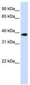 Glycerol-3-Phosphate Dehydrogenase 1 Like antibody, TA333844, Origene, Western Blot image 