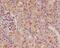 Cyclin Dependent Kinase Inhibitor 1C antibody, M01244-2, Boster Biological Technology, Immunohistochemistry paraffin image 