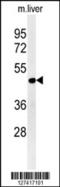 DNA Damage Inducible 1 Homolog 2 antibody, 62-115, ProSci, Western Blot image 