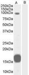 Rho GTPase Activating Protein 26 antibody, PA1-31264, Invitrogen Antibodies, Western Blot image 