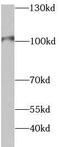 Hexokinase 2 antibody, FNab09956, FineTest, Western Blot image 