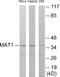 MNAT1 Component Of CDK Activating Kinase antibody, EKC1737, Boster Biological Technology, Western Blot image 