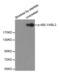 ABL Proto-Oncogene 1, Non-Receptor Tyrosine Kinase antibody, LS-C335935, Lifespan Biosciences, Western Blot image 