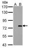 P21 (RAC1) Activated Kinase 6 antibody, GTX107861, GeneTex, Western Blot image 