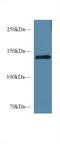 Semaphorin 4D antibody, LS-C374133, Lifespan Biosciences, Western Blot image 