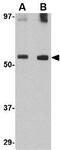 Growth Differentiation Factor 6 antibody, GTX31348, GeneTex, Western Blot image 