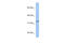 Acyl-CoA Binding Domain Containing 4 antibody, 26-455, ProSci, Western Blot image 