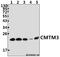 CKLF Like MARVEL Transmembrane Domain Containing 3 antibody, A11481-1, Boster Biological Technology, Western Blot image 