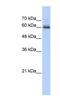 Ssemaphorin 4F antibody, NBP1-59942, Novus Biologicals, Western Blot image 