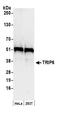Thyroid Hormone Receptor Interactor 6 antibody, A300-334A, Bethyl Labs, Western Blot image 
