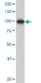 ADAM Metallopeptidase With Thrombospondin Type 1 Motif 2 antibody, H00009509-M03, Novus Biologicals, Western Blot image 