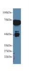 Alpha-1-Microglobulin/Bikunin Precursor antibody, LS-C300814, Lifespan Biosciences, Western Blot image 