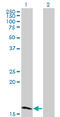 Zinc Finger Protein 44 antibody, LS-C134071, Lifespan Biosciences, Western Blot image 