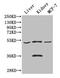 S protein antibody, CSB-PA005124LA01HU, Cusabio, Western Blot image 