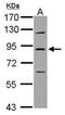 Phospholipase A2 Group VI antibody, GTX103717, GeneTex, Western Blot image 