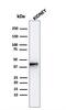 Alpha-Methylacyl-CoA Racemase antibody, GTX02586, GeneTex, Western Blot image 