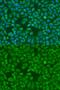 Insulin Like Growth Factor 2 MRNA Binding Protein 1 antibody, GTX54359, GeneTex, Immunofluorescence image 