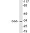 Cyclin Dependent Kinase 5 antibody, LS-C199809, Lifespan Biosciences, Western Blot image 