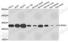 Snail Family Transcriptional Repressor 1 antibody, A5243, ABclonal Technology, Western Blot image 