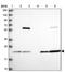 Proteasome Subunit Beta 8 antibody, NBP2-47396, Novus Biologicals, Western Blot image 