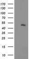 Phosphatidylinositol-5-Phosphate 4-Kinase Type 2 Alpha antibody, MA5-25383, Invitrogen Antibodies, Western Blot image 