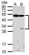 Protein C Receptor antibody, PA5-32217, Invitrogen Antibodies, Western Blot image 