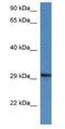 Harbinger Transposase Derived 1 antibody, NBP1-74230, Novus Biologicals, Western Blot image 